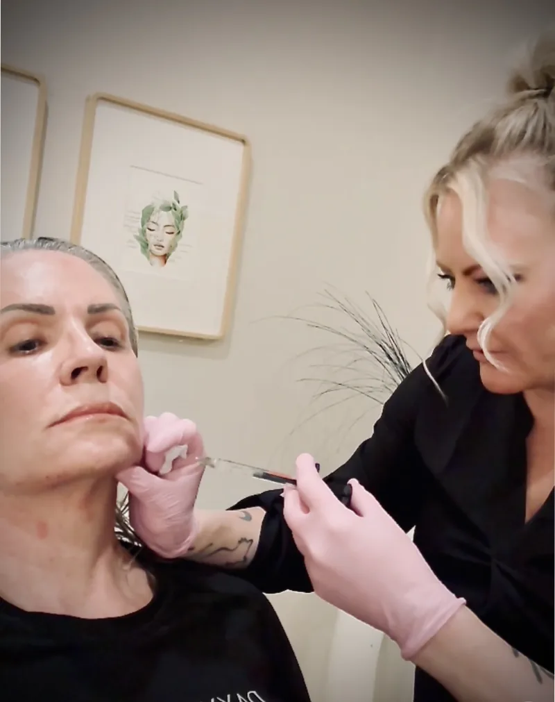 Masseter Botox injection along the jawline in Austin