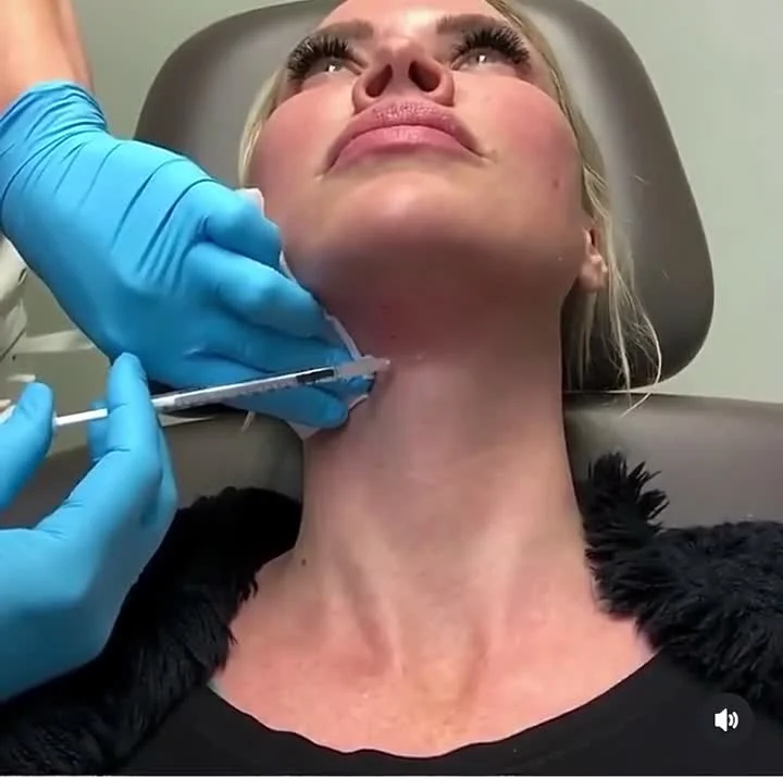 Nefertiti neck lift treatment at Banyan & Bamboo in Austin