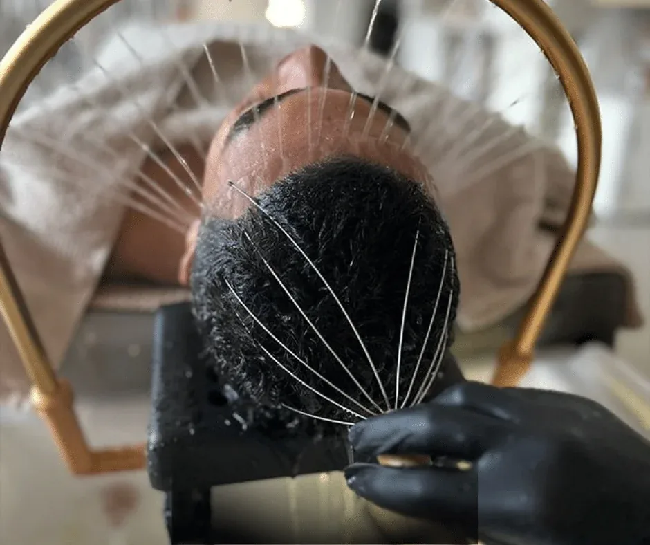 Scalp treatment tool during hair restoration at Banyan & Bamboo in Austin