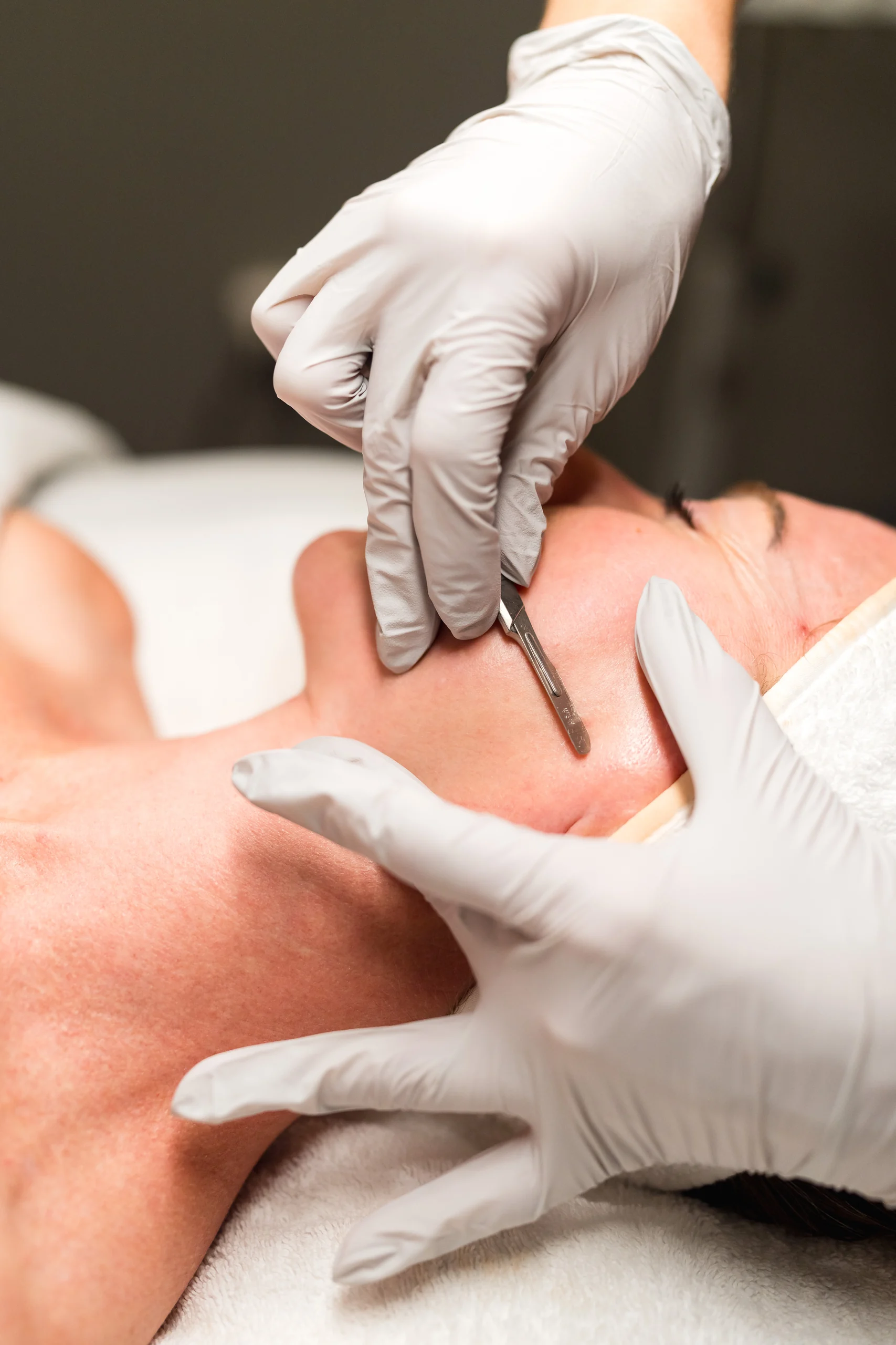 Dermaplane facial exfoliation treatment at Banyan and Bamboo day spa South Lamar Austin TX