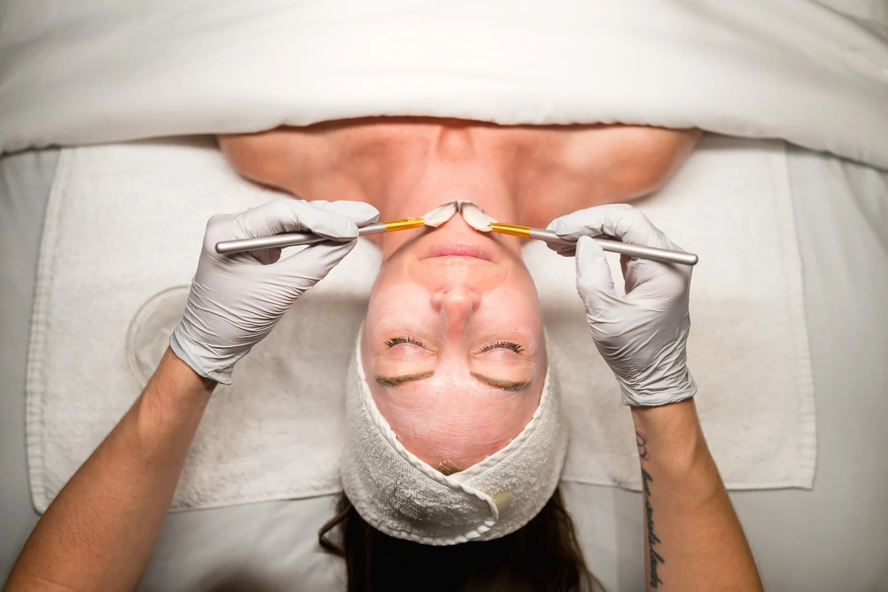 Perfect Derma Peel chemical peel treatment special at Banyan and Bamboo Austin TX South Lamar